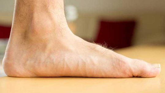 ۱۰  تمرین عالی برای بهبود کف پای صاف